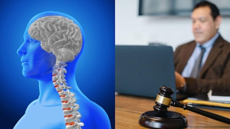 How to File a Brain Injury Claim with the Assistance of an Attorney